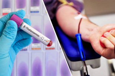 Beta-talassemia: una nuova terapia può ridurre di oltre il 30% le trasfusioni di sangue