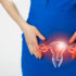 Tumore dell’endometrio: disponibile la prima immunoterapia “su misura”