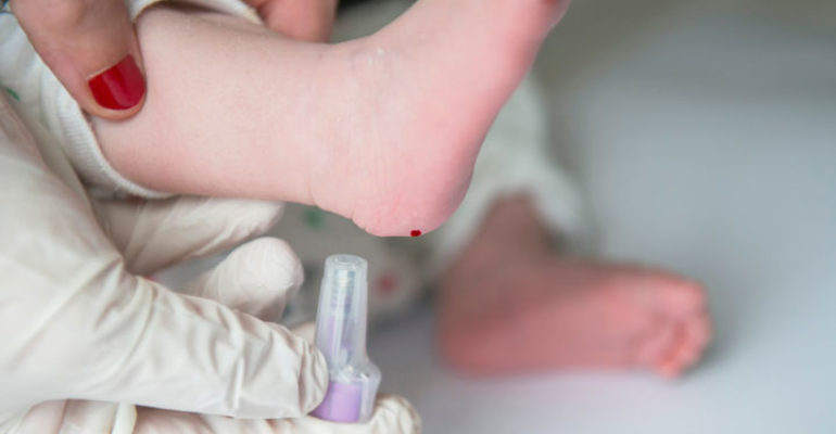 Screening neonatali “estesi”: a che punto siamo