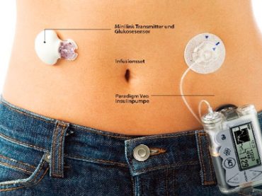 DIABETE: PIU’ ATTENZIONE ALLE DONNE E AI BAMBINI, CON I NUOVI MICROINFUSORI