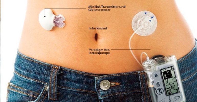 DIABETE: PIU’ ATTENZIONE ALLE DONNE E AI BAMBINI, CON I NUOVI MICROINFUSORI