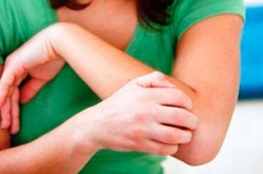 I DISTURBI ESTIVI PIU’ FREQUENTI: COME PREVENIRLI E CURARLI