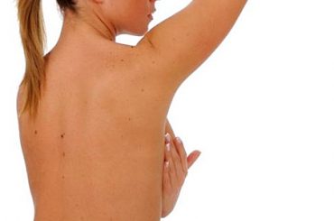 SVUOTAMENTO ASCELLARE? NO SE IL TUMORE AL SENO E’ IN FASE INIZIALE