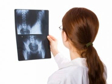 MESE DELLA PREVENZIONE: 10 DOMANDE SULL’OSTEOPOROSI