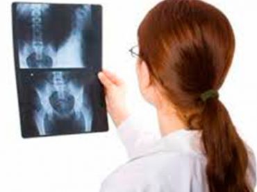 FRAGILITA’ OSSEA: QUANTO NE SANNO LE DONNE ITALIANE?