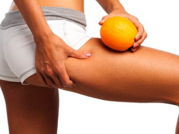 COME COMBATTERE LA CELLULITE CON STILE DI VITA E INTEGRATORI ADATTI