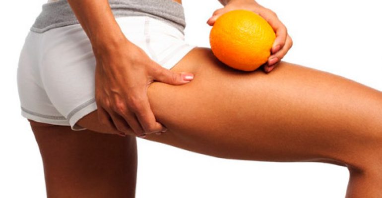 COME COMBATTERE LA CELLULITE CON STILE DI VITA E INTEGRATORI ADATTI