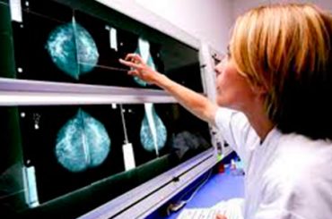 CON LA DIAGNOSI PRECOCE SI GUARISCE DAL TUMORE AL SENO