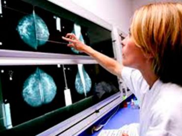 CON LA DIAGNOSI PRECOCE SI GUARISCE DAL TUMORE AL SENO