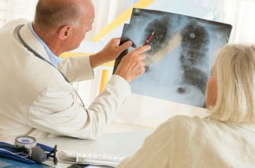 “PROGRAMMA POLMONE”: LA NUOVA SFIDA DELLO IEO