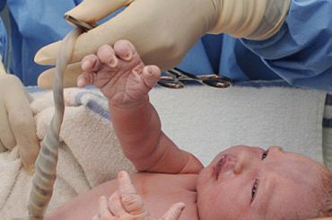 LE STAMINALI DEL CORDONE OMBELICALE FINISCONO IN BANCA