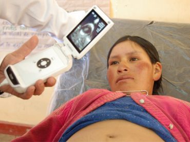 UN MINI-ECOGRAFO PER FARE DIAGNOSI NEI PAESI PIU’ POVERI