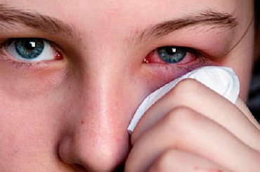 OCCHI SECCHI E ARROSSATI: PIU’ A RISCHIO LE DONNE