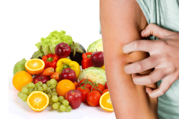 La tavola delle feste per chi soffre di psoriasi