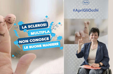Nuove speranze per la Sclerosi Multipla