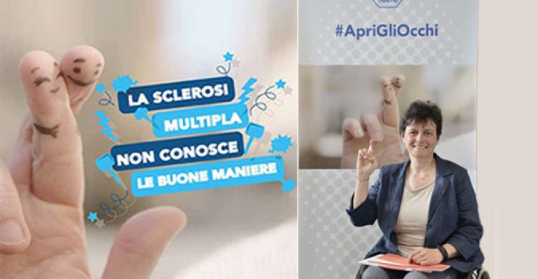 Nuove speranze per la Sclerosi Multipla