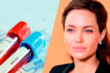 “Effetto Jolie”: gli oncologi Aiom a favore del test Brca