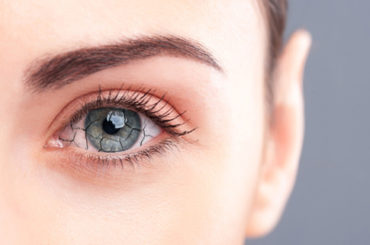 Occhio secco: tre volte più frequente nelle donne