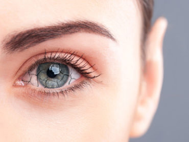 Occhio secco: tre volte più frequente nelle donne