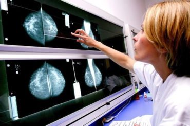 Promettenti novità per il tumore al seno, già inserito “in rete”