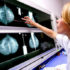 Promettenti novità per il tumore al seno, già inserito “in rete”