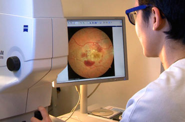 Retinopatia diabetica: un nuovo dispositivo per la diagnosi