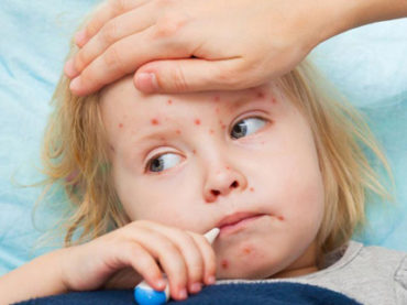 Obblighi vaccinali: il morbillo spiegato in 8 punti