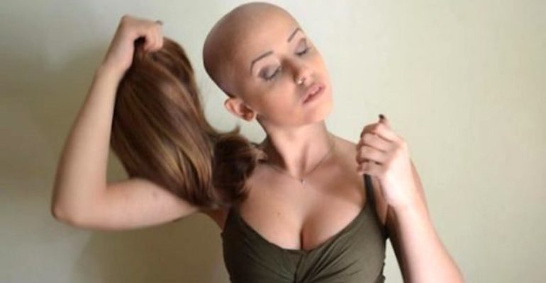 Tumore al seno: il 30% delle donne non toglie la parrucca