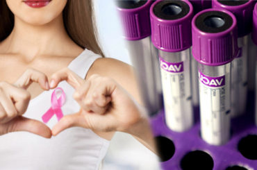 Test genetico BRCA: anche alle donne sane, con familiari malati?