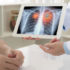 Tumore del polmone: l’immunoterapia può diventare una cura