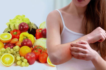 I cibi giusti per “disinfiammare” la psoriasi