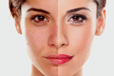 Bella… senza macchia