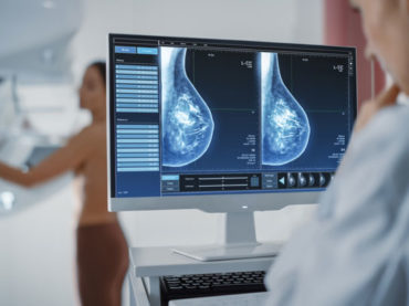 Tumore al seno: diagnosi e cure più precise con l’intelligenza artificiale