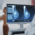 Tumore al seno: diagnosi e cure più precise con l’intelligenza artificiale