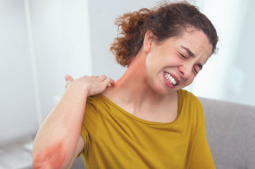 Dermatite atopica, malattie allergiche, melanoma: i rischi si accentuano in estate