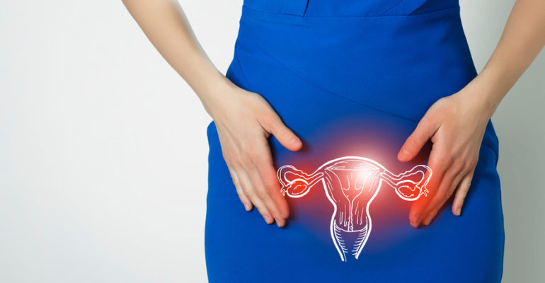 Tumore dell’endometrio: disponibile la prima immunoterapia “su misura”