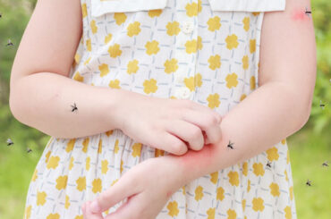 Come difendersi dal rischio di punture degli insetti