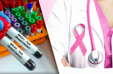 Tumori con mutazione BRCA: l’importanza dei test per identificarli