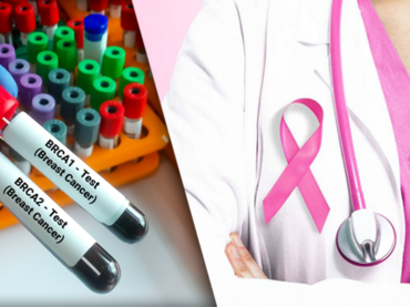 Tumori con mutazione BRCA: l’importanza dei test per identificarli