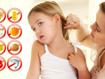 In aumento le allergie nei piccoli: più conoscenze e novità terapeutiche