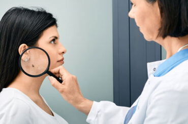 “SUNrise: facciamo luce sul melanoma”