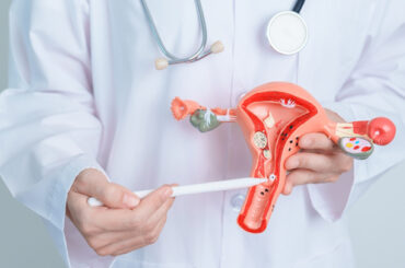 Endometriosi: più consapevolezza sul rischio infertilità