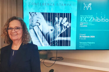 Eczema alle mani: una nuova opzione terapeutica