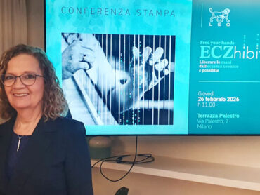 Eczema alle mani: una nuova opzione terapeutica