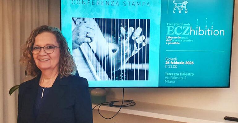 Eczema alle mani: una nuova opzione terapeutica