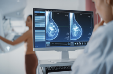 Tumore al seno: dallo screening ai test molecolari
