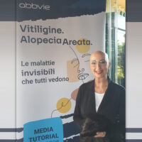 Alopecia e vitiligine: un nuovo farmaco per due malattie dermatologiche