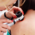 Vaccino personalizzato contro il melanoma