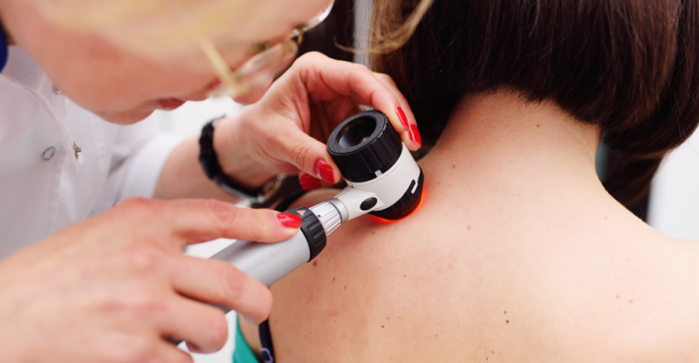 Vaccino personalizzato contro il melanoma